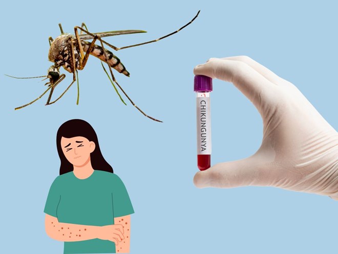 Bệnh Chikungunya chưa có thuốc đặc hiệu, chủ yếu điều trị các triệu chứng