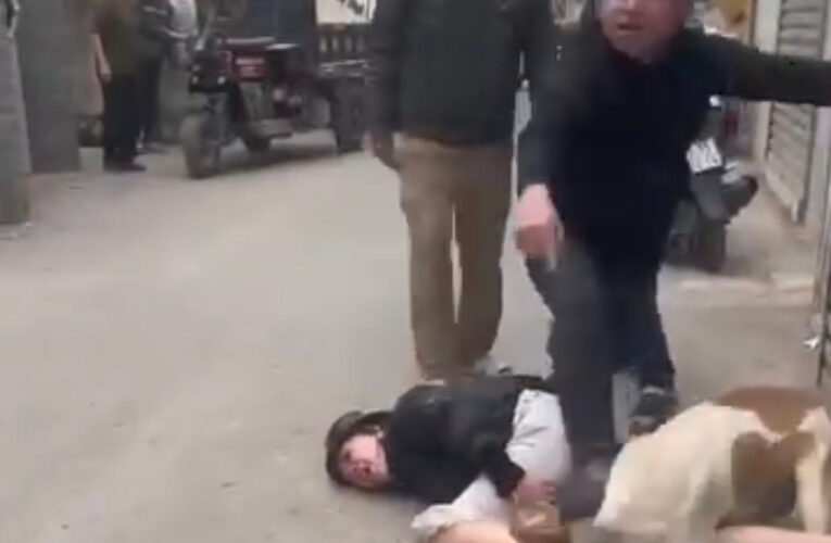 [CLIP] Hà Nội: Xác minh thông tin thả chó cắn vào mặt, chân người phụ nữ đi đường